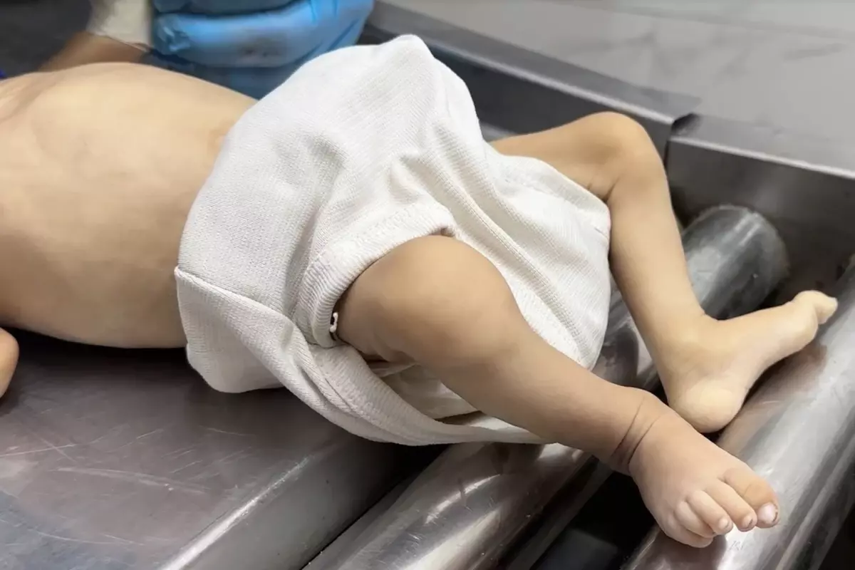 Gazze'de açlıktan bebeğini kaybeden baba: 